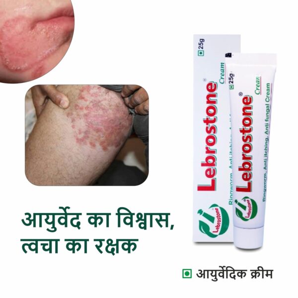 Lebrostone Ayurvedic Skin Care Treatment Cream 25g